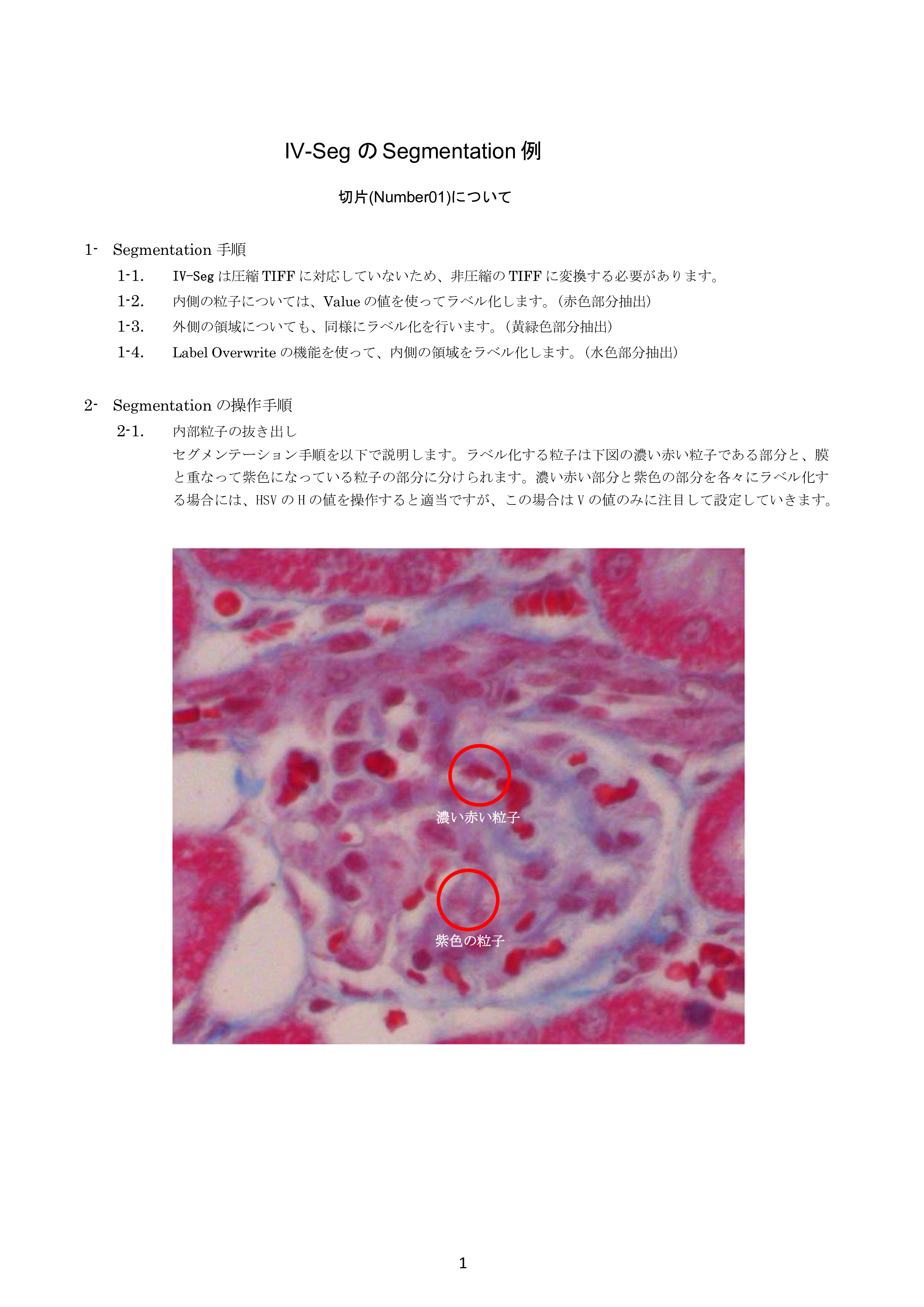 IV-Seg_Segmentation01-0.png