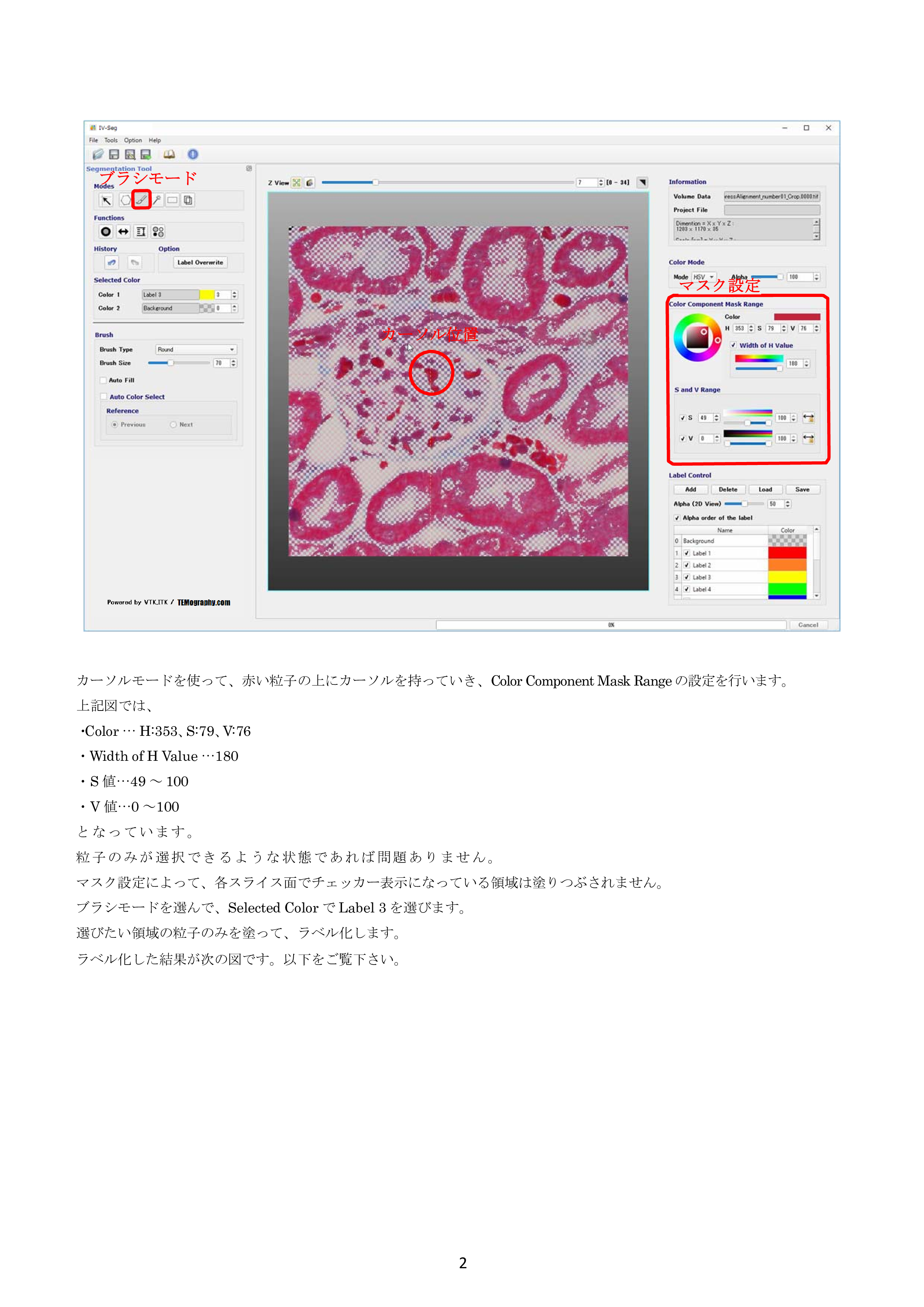 IV-Seg_Segmentation01-1.png