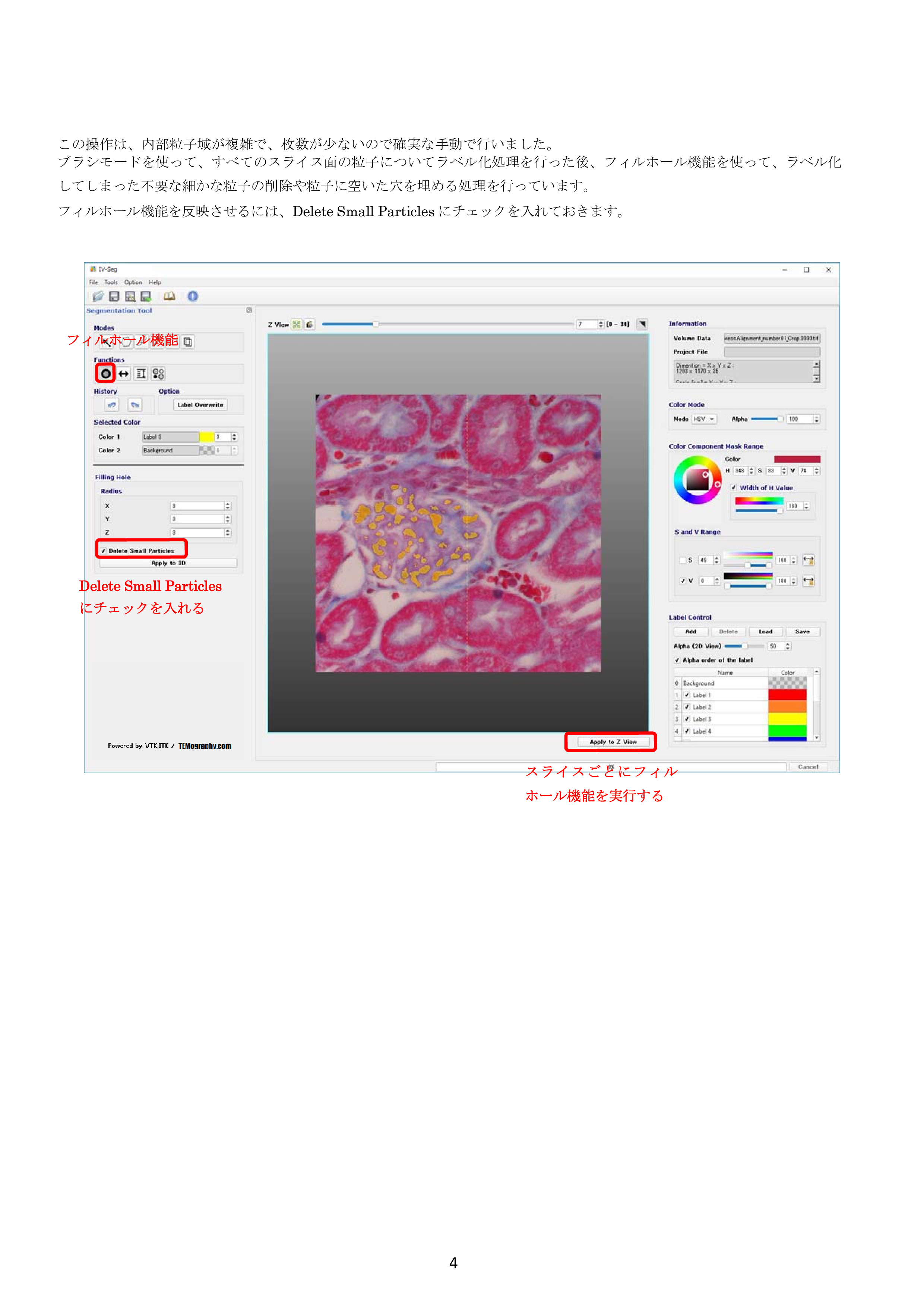 IV-Seg_Segmentation01-3.png