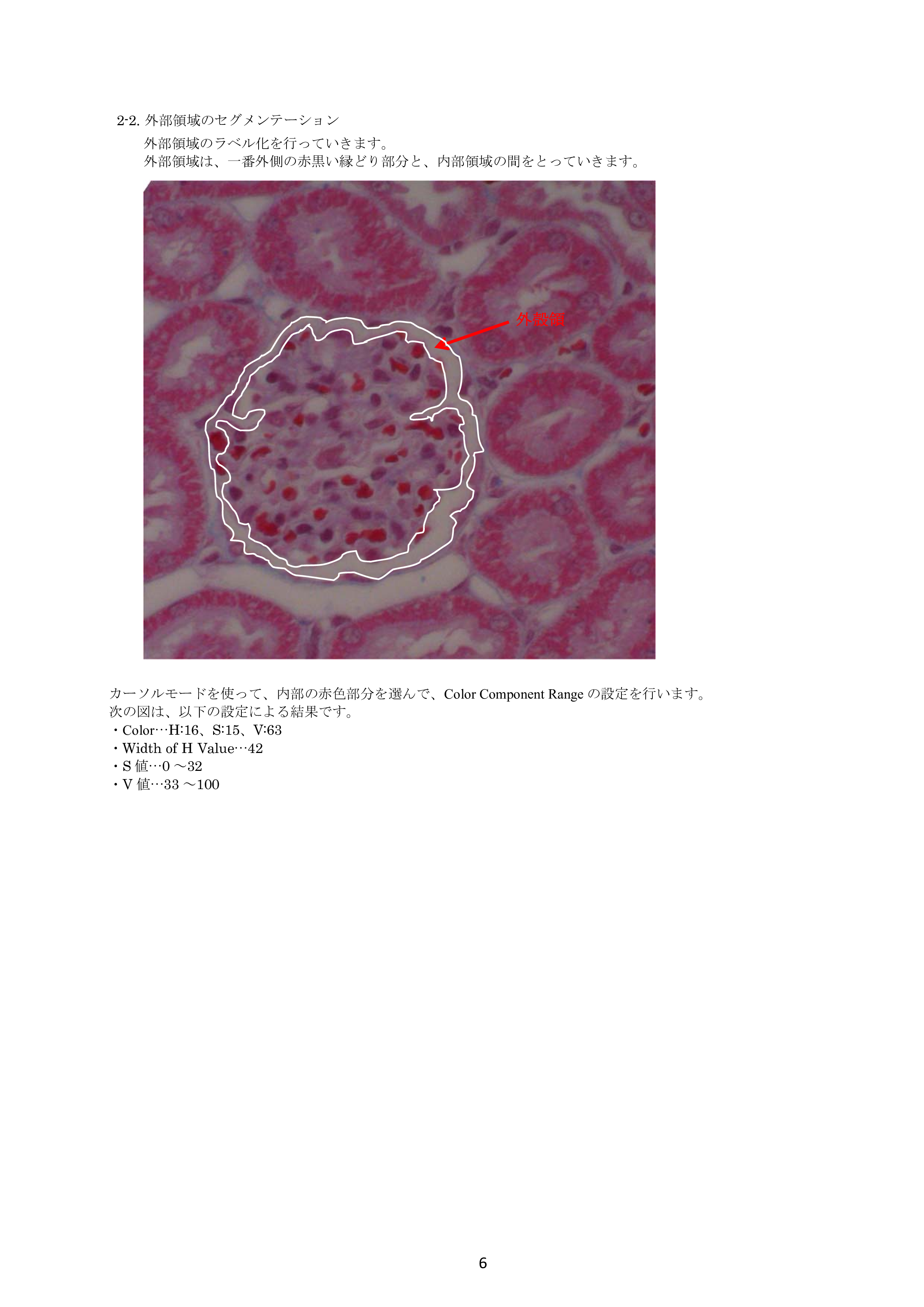 IV-Seg_Segmentation01-5.png