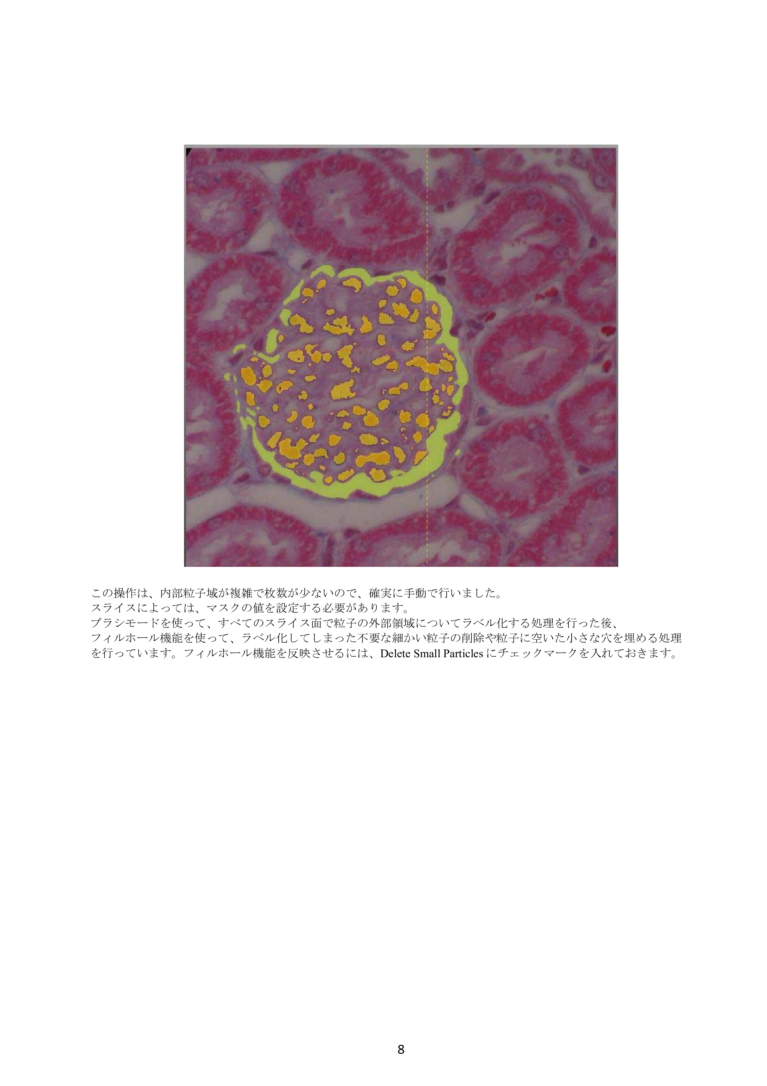 IV-Seg_Segmentation01-7.png