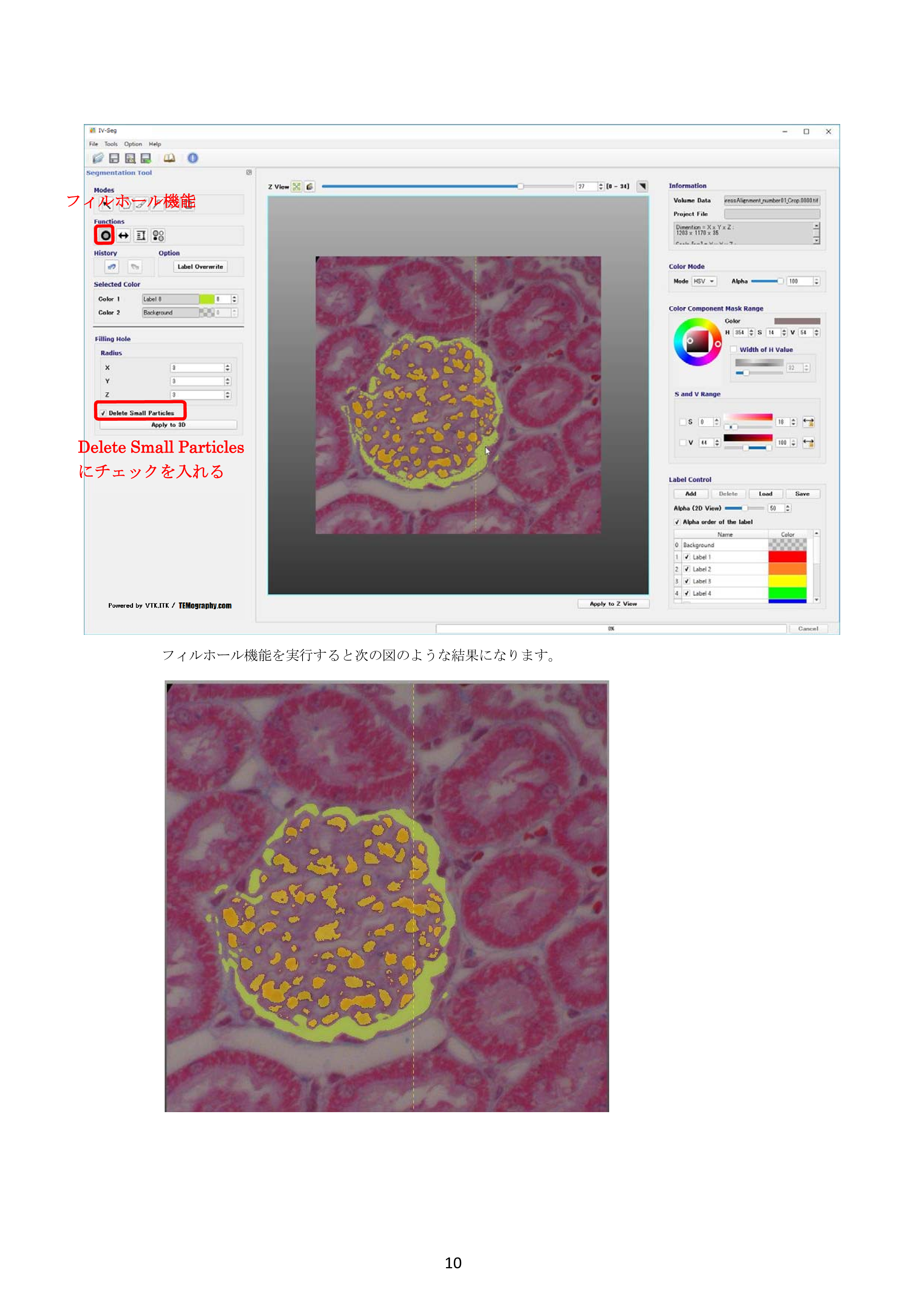 IV-Seg_Segmentation01-9.png