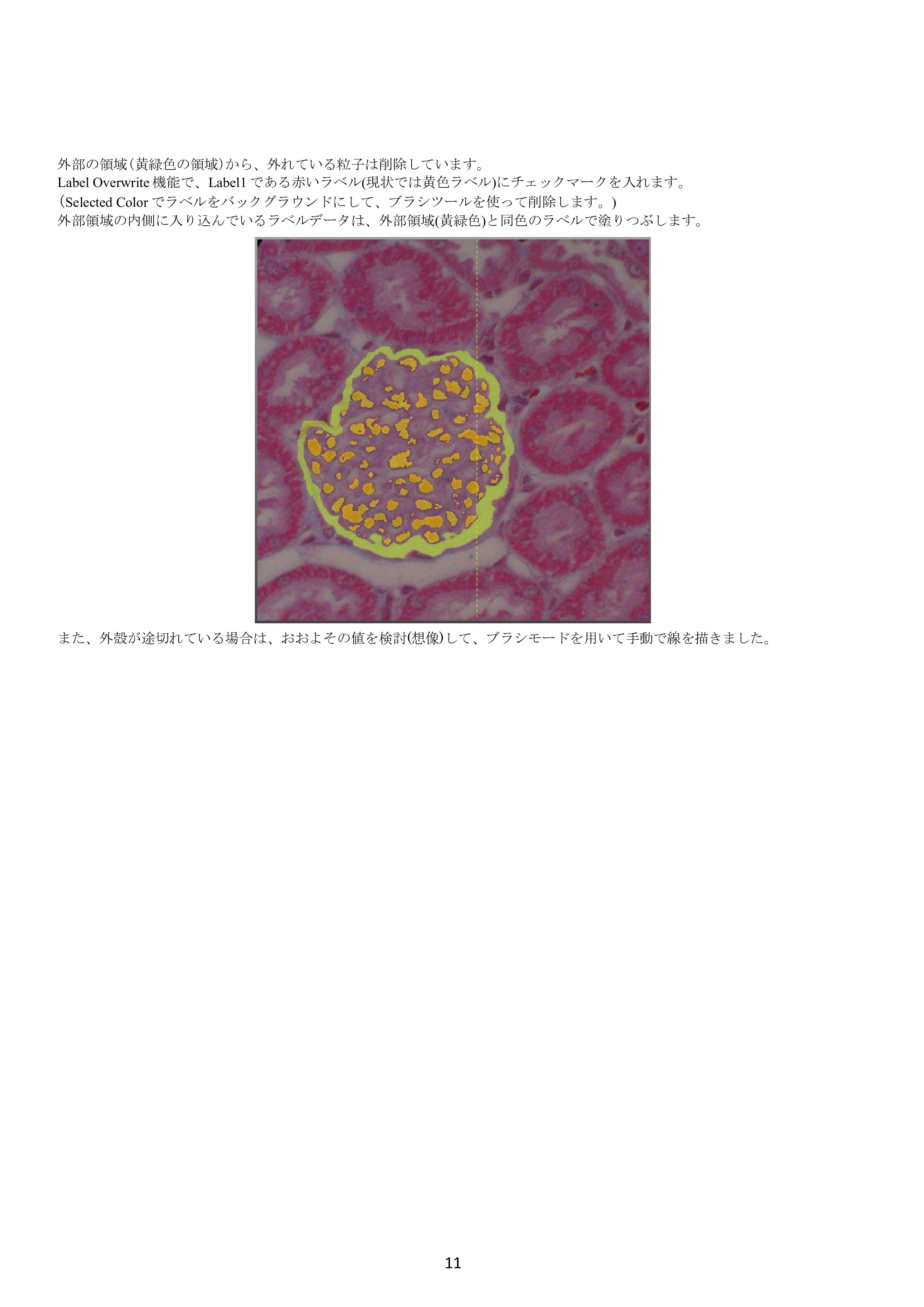 IV-Seg_Segmentation01-10.png