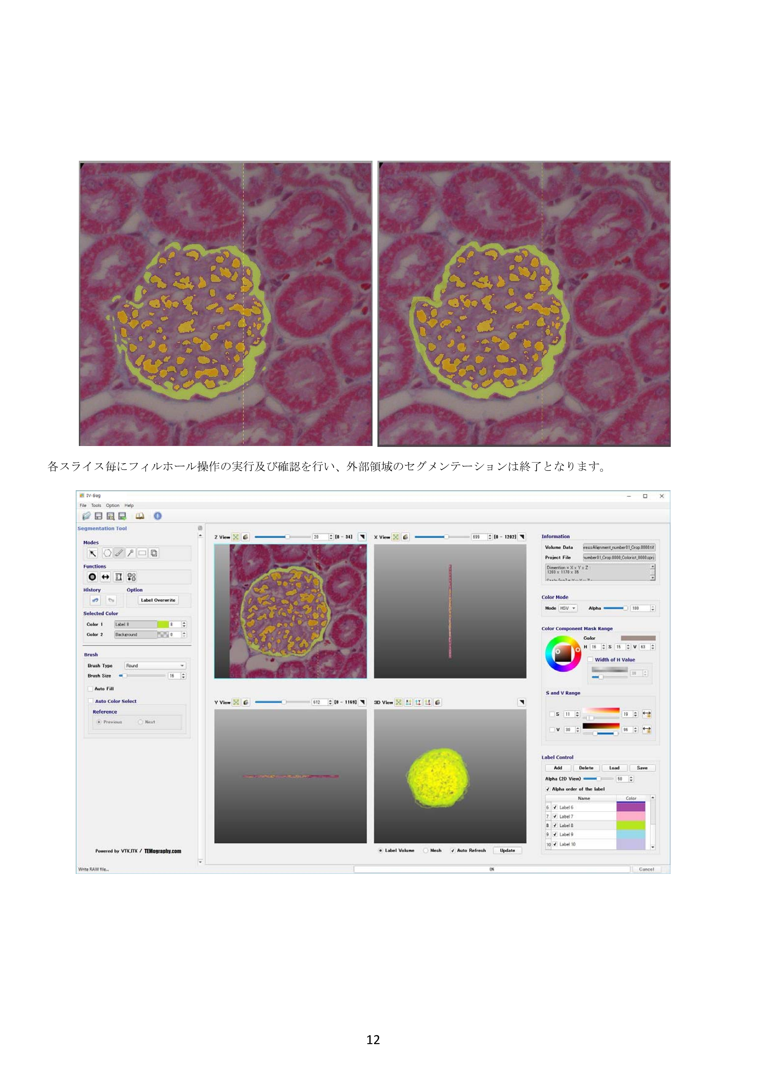 IV-Seg_Segmentation01-11.png