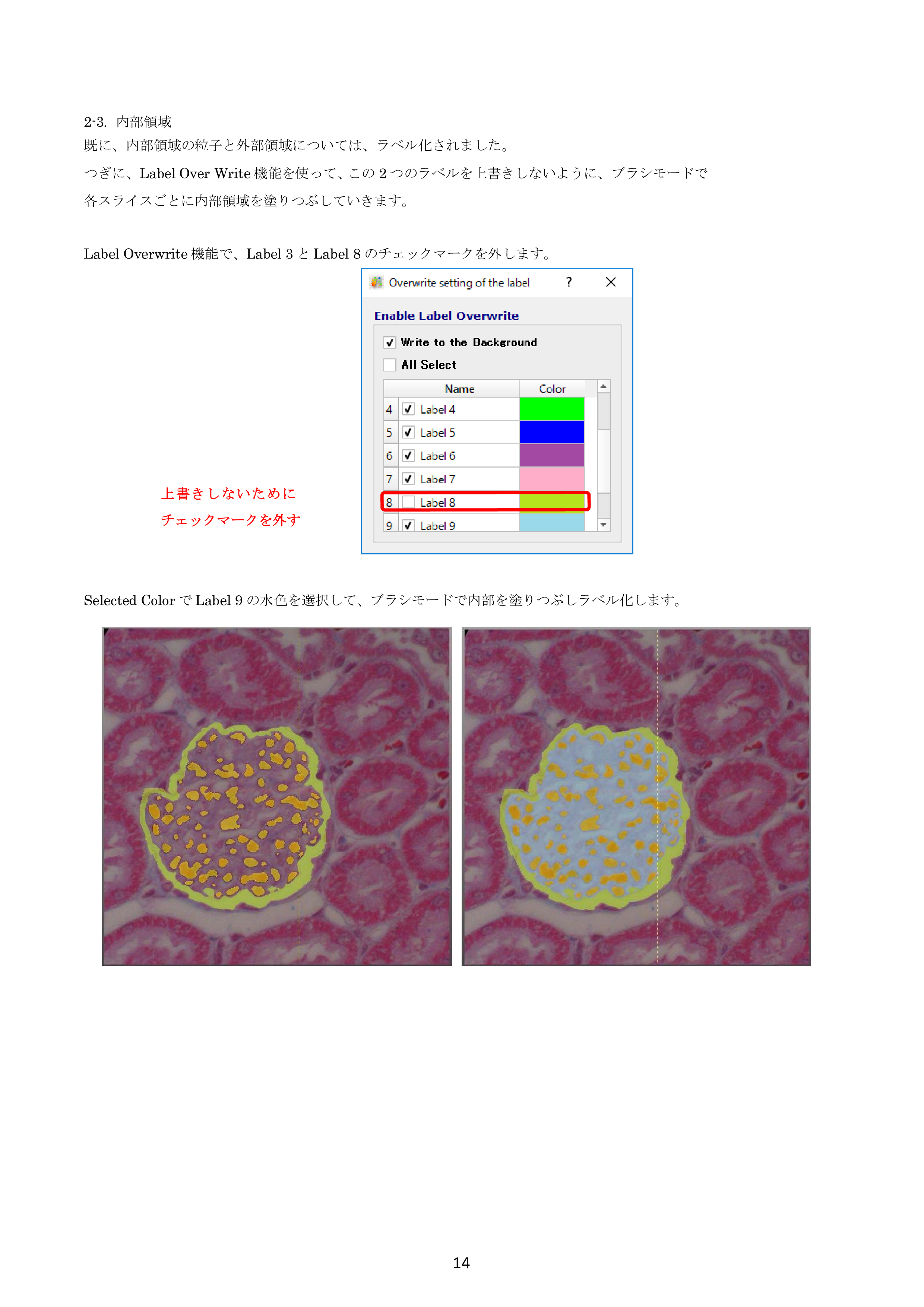 IV-Seg_Segmentation01-13.png