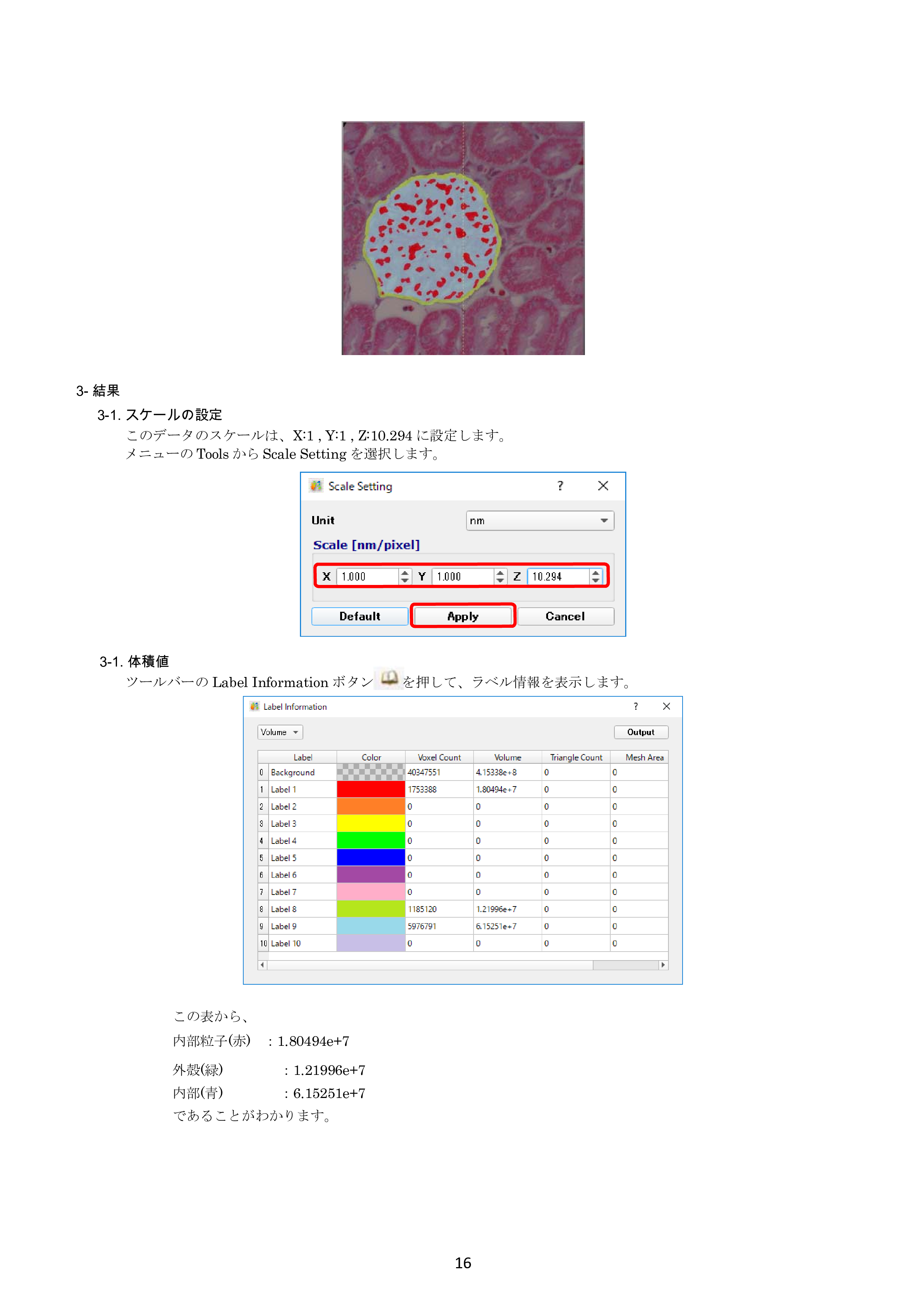 IV-Seg_Segmentation01-15.png