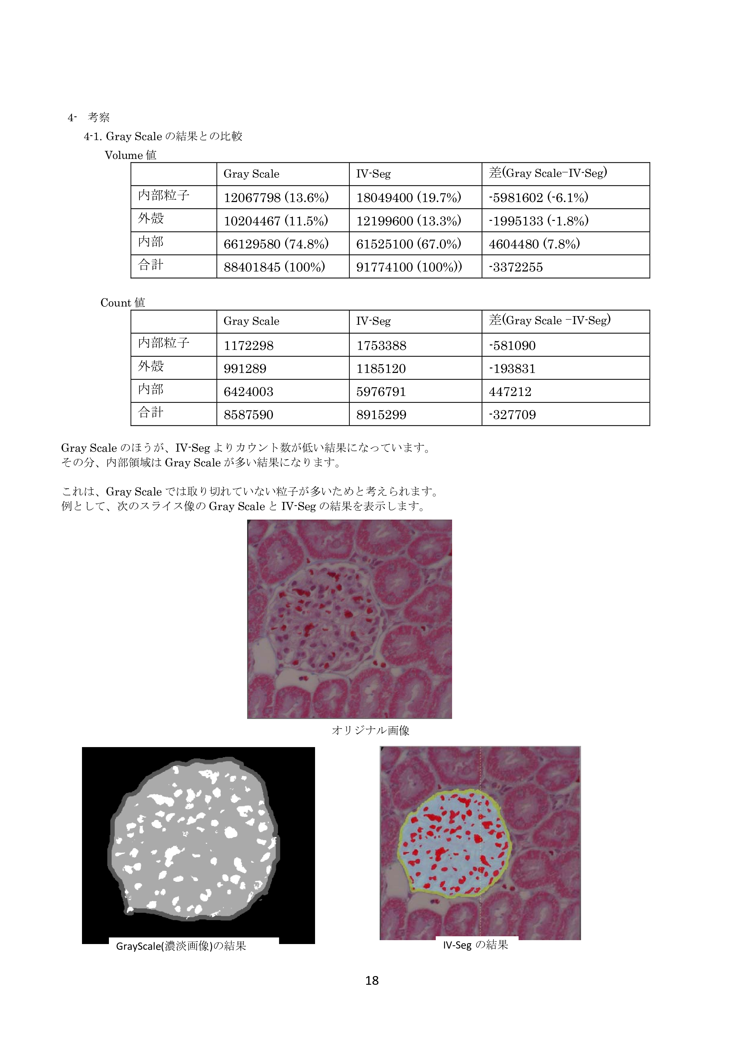 IV-Seg_Segmentation01-17.png