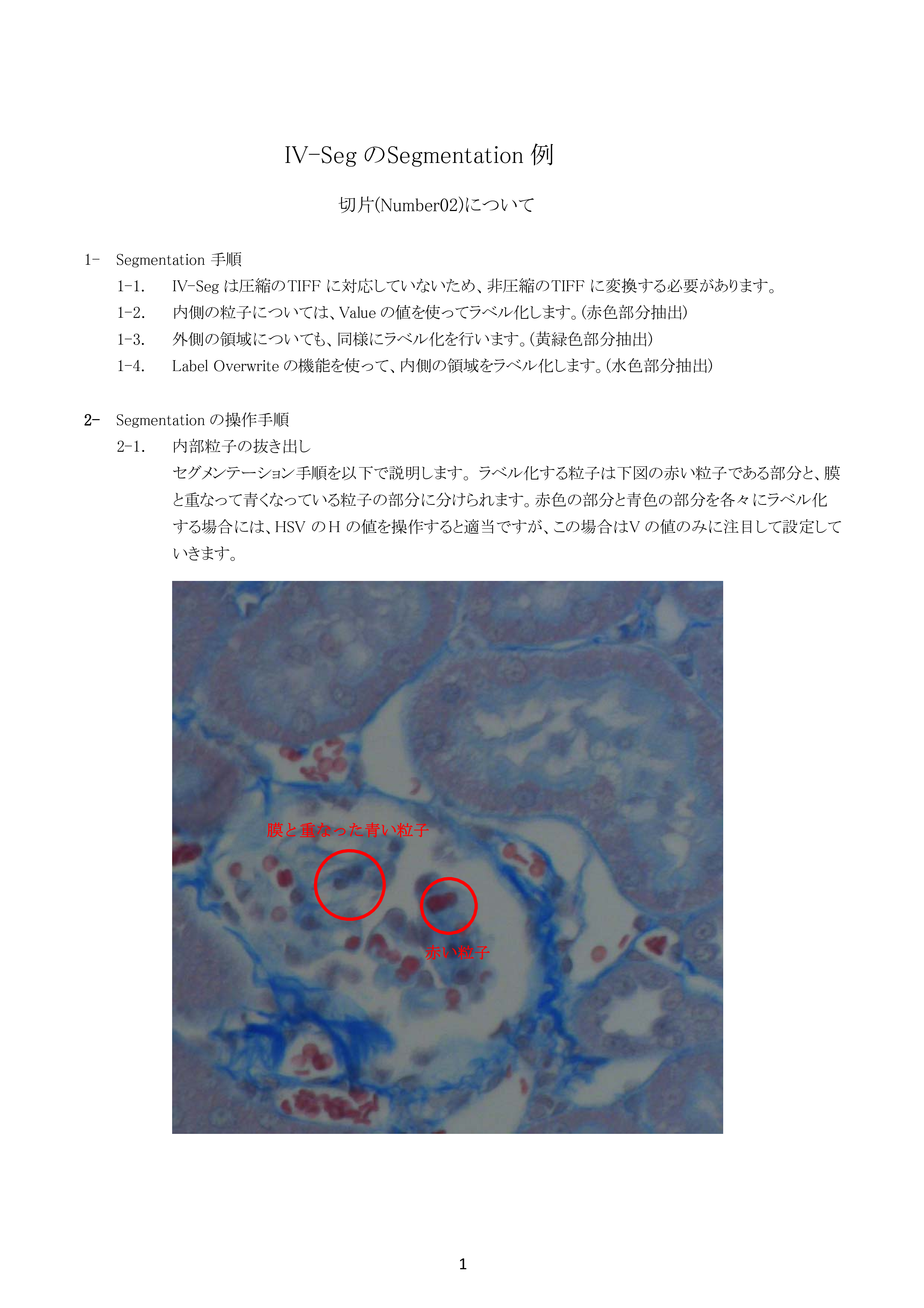 IV-Seg_Segmentation02-0.png