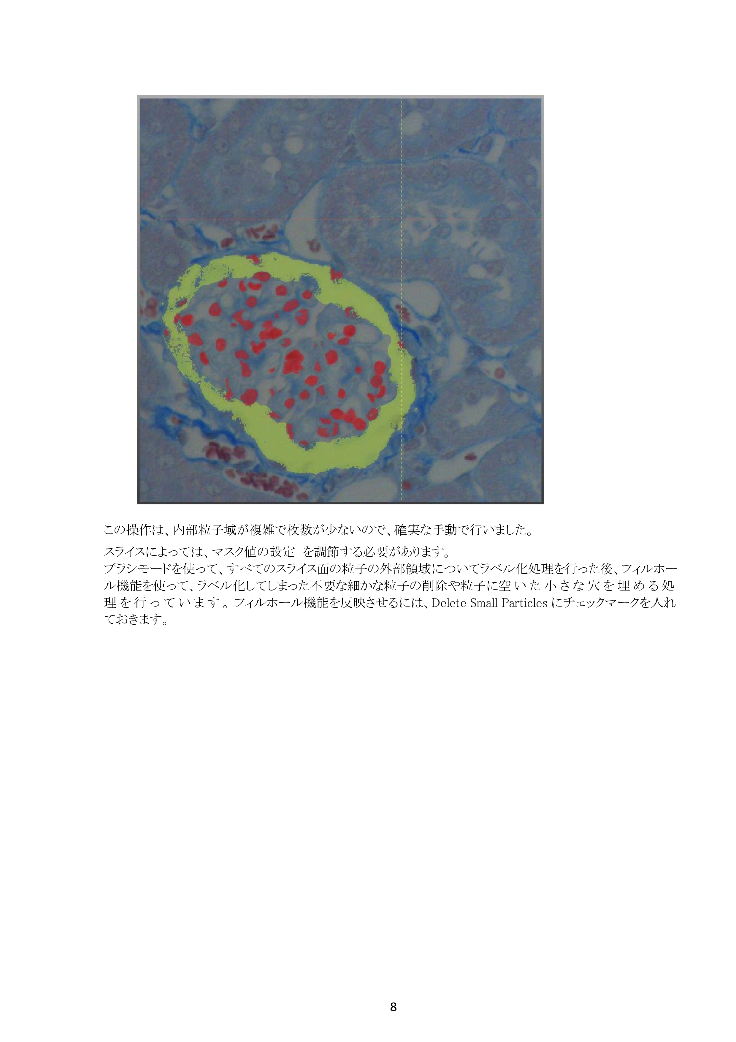 IV-Seg_Segmentation02-7.png