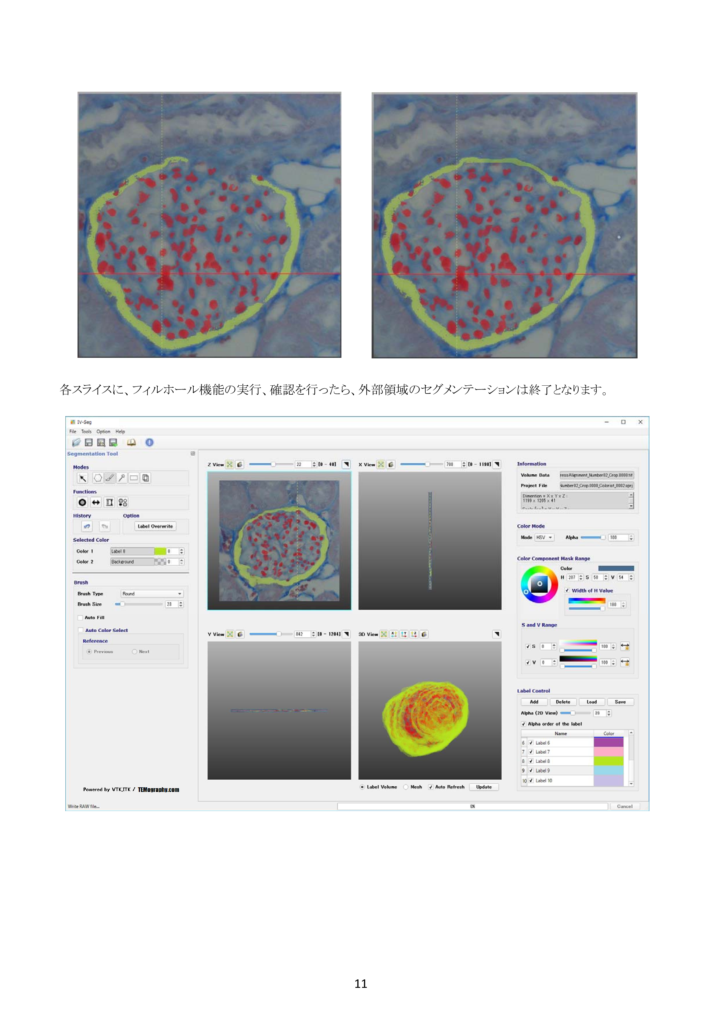 IV-Seg_Segmentation02-10.png