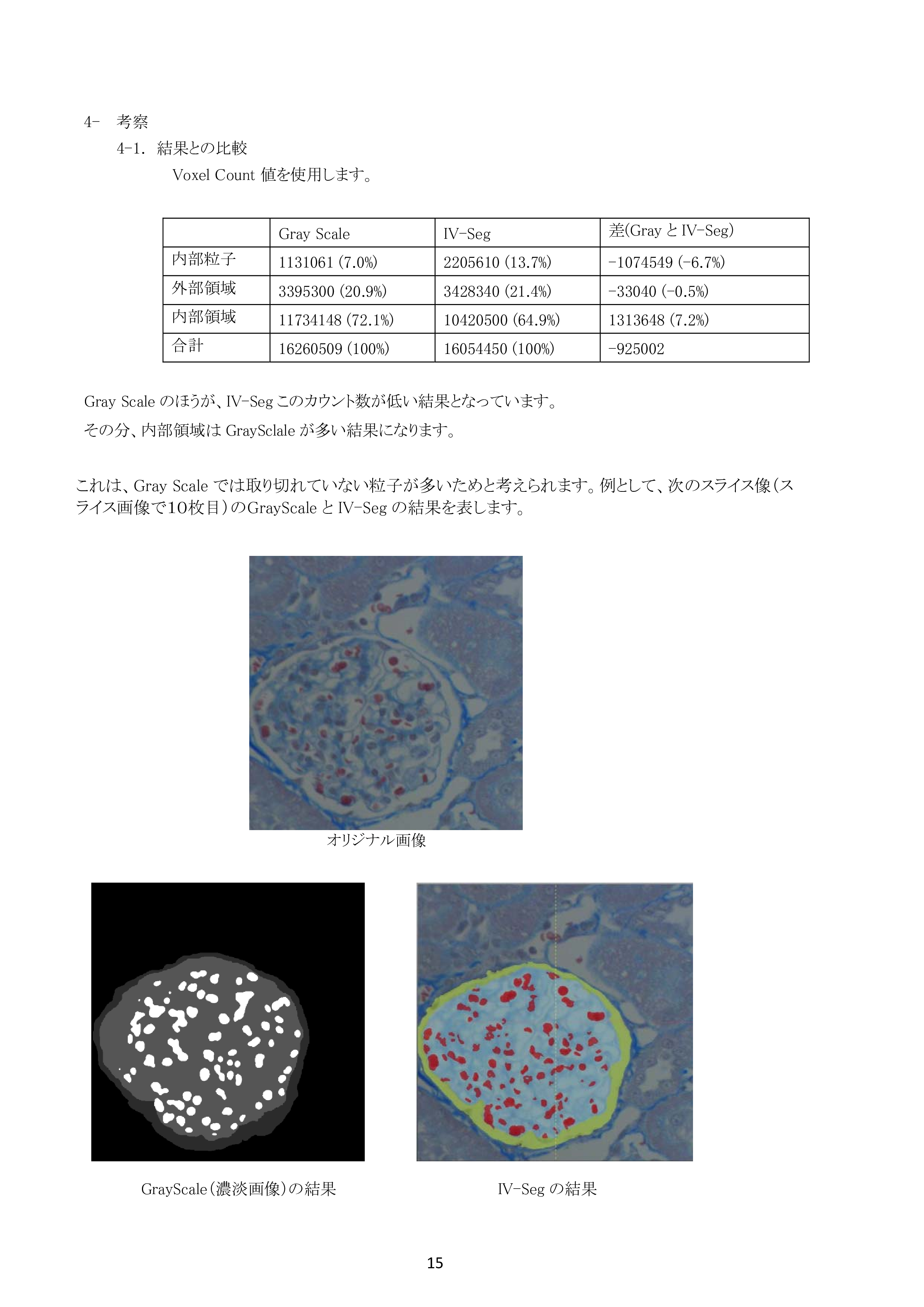 IV-Seg_Segmentation02-14.png