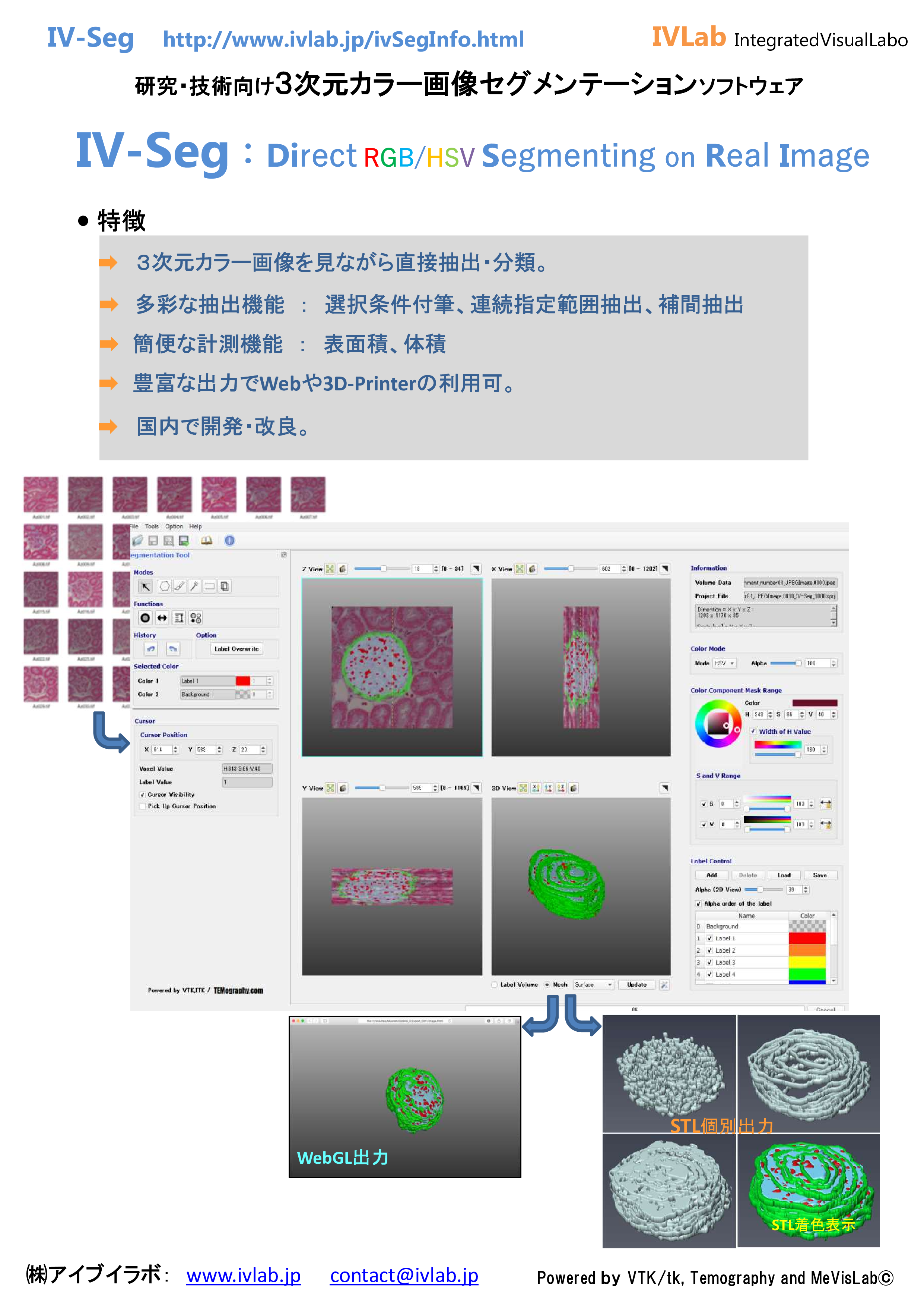 IV-Seg_2P2017Sep21IVLab-0.png